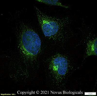 Immunocytochemistry/Immunofluorescence: GM130/GOLGA2 Antibody [FITC] [NBP2-53420F] - HeLa cells were fixed in 4% paraformaldehyde for 10 minutes and permeabilized in 0.05% Triton X-100 in PBS for 5 minutes. The cells were incubated with GM130/GOLGA2 Antibody conjugated to FITC (NBP2-53420F) at 5 ug/ml for 1 hour at room temperature. Nuclei were counterstained with DAPI (Blue). Cells were imaged using a 100X objective and digitally deconvolved.